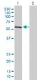 Erythrocyte Membrane Protein Band 4.1 antibody, H00002035-D01P, Novus Biologicals, Western Blot image 