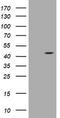 Alpha-Methylacyl-CoA Racemase antibody, CF800813, Origene, Western Blot image 