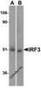 Interferon Regulatory Factor 3 antibody, 3399, ProSci Inc, Western Blot image 