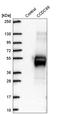 Coiled-Coil Domain Containing 89 antibody, HPA040628, Atlas Antibodies, Western Blot image 