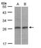 RAB4A, Member RAS Oncogene Family antibody, PA5-28863, Invitrogen Antibodies, Western Blot image 