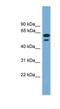 Testis Expressed 45 antibody, NBP1-91471, Novus Biologicals, Western Blot image 