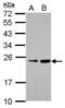 Ras-related protein Rab-39B antibody, PA5-31147, Invitrogen Antibodies, Western Blot image 