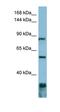 Epidermal growth factor receptor kinase substrate 8 antibody, orb330775, Biorbyt, Western Blot image 