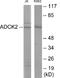 AarF Domain Containing Kinase 2 antibody, EKC1861, Boster Biological Technology, Western Blot image 