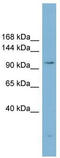 ATP Citrate Lyase antibody, TA329521, Origene, Western Blot image 
