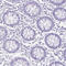 Keratin 10 antibody, HPA012014, Atlas Antibodies, Immunohistochemistry frozen image 