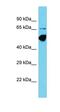 Centrosomal Protein 83 antibody, orb326775, Biorbyt, Western Blot image 