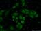 Replication Termination Factor 2 antibody, 16633-1-AP, Proteintech Group, Immunofluorescence image 