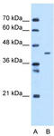 Mitochondrial carrier homolog 1 antibody, TA341931, Origene, Western Blot image 