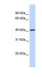 Cytochrome P450 Family 4 Subfamily F Member 12 antibody, NBP1-62384, Novus Biologicals, Western Blot image 