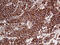 60S ribosomal protein L10a antibody, M08606, Boster Biological Technology, Immunohistochemistry paraffin image 