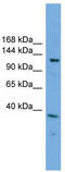 Eukaryotic Translation Initiation Factor 4E Nuclear Import Factor 1 antibody, TA344814, Origene, Western Blot image 
