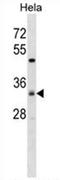 Zinc Finger DHHC-Type Containing 7 antibody, AP54633PU-N, Origene, Western Blot image 