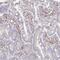 Slingshot Protein Phosphatase 2 antibody, HPA057099, Atlas Antibodies, Immunohistochemistry paraffin image 