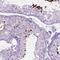 Late Cornified Envelope Like Proline Rich 1 antibody, NBP2-49624, Novus Biologicals, Immunohistochemistry paraffin image 