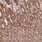 Coiled-Coil Domain Containing 140 antibody, PA5-60002, Invitrogen Antibodies, Immunohistochemistry frozen image 