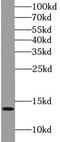 DMRT Like Family C1B antibody, FNab02427, FineTest, Western Blot image 