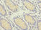 G Elongation Factor Mitochondrial 2 antibody, LS-C675807, Lifespan Biosciences, Immunohistochemistry paraffin image 