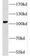 Sperm Associated Antigen 9 antibody, FNab08147, FineTest, Western Blot image 