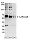Ajuba LIM Protein antibody, A304-867A, Bethyl Labs, Western Blot image 