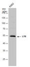 LYN Proto-Oncogene, Src Family Tyrosine Kinase antibody, GTX130460, GeneTex, Western Blot image 