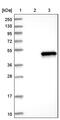 Beta-sarcoglycan antibody, PA5-52835, Invitrogen Antibodies, Western Blot image 
