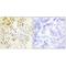 Cyclin L1 antibody, A04105, Boster Biological Technology, Immunohistochemistry paraffin image 