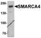 SWI/SNF Related, Matrix Associated, Actin Dependent Regulator Of Chromatin, Subfamily A, Member 4 antibody, 7749, ProSci Inc, Western Blot image 