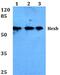 Hexosaminidase Subunit Beta antibody, PA5-36146, Invitrogen Antibodies, Western Blot image 