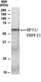 Pre-MRNA Processing Factor 31 antibody, NBP1-51909, Novus Biologicals, Western Blot image 