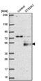 Disialoganglioside GD3 antibody, NBP1-80750, Novus Biologicals, Western Blot image 