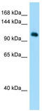 Histone H2A deubiquitinase MYSM1 antibody, TA334333, Origene, Western Blot image 