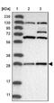 Cytochrome C Oxidase Assembly Factor 7 (Putative) antibody, NBP1-87393, Novus Biologicals, Western Blot image 