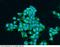 Insulin Like Growth Factor 1 Receptor antibody, 10164-R012, Sino Biological, Immunohistochemistry paraffin image 