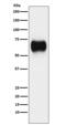 MHC Class I Polypeptide-Related Sequence A antibody, M01366, Boster Biological Technology, Western Blot image 