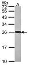 NADH dehydrogenase [ubiquinone] iron-sulfur protein 8, mitochondrial antibody, orb69747, Biorbyt, Western Blot image 