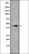 Ribosomal Protein L14 antibody, orb337514, Biorbyt, Western Blot image 