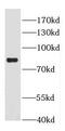 Diacylglycerol Kinase Alpha antibody, FNab02356, FineTest, Western Blot image 