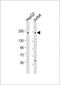 Laminin Subunit Beta 2 antibody, GTX81697, GeneTex, Western Blot image 