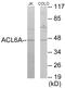 Actin Like 6A antibody, EKC1667, Boster Biological Technology, Western Blot image 