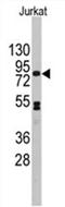 Cadherin 12 antibody, AP11470PU-N, Origene, Western Blot image 