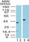 C-C Motif Chemokine Receptor 1 antibody, PA1-41148, Invitrogen Antibodies, Western Blot image 