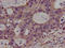 Protein Kinase N2 antibody, LS-C670956, Lifespan Biosciences, Immunohistochemistry paraffin image 