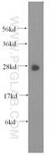 Glutathione S-transferase theta-1 antibody, 15838-1-AP, Proteintech Group, Western Blot image 