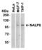 NLR Family Pyrin Domain Containing 6 antibody, PA5-21022, Invitrogen Antibodies, Western Blot image 