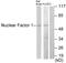 Nuclear Factor I A antibody, LS-C119003, Lifespan Biosciences, Western Blot image 