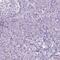 Gamma-Aminobutyric Acid Type A Receptor Beta2 Subunit antibody, HPA067632, Atlas Antibodies, Immunohistochemistry frozen image 