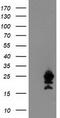 Ubiquitin Conjugating Enzyme E2 M antibody, CF503770, Origene, Western Blot image 