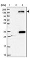 StAR Related Lipid Transfer Domain Containing 13 antibody, NBP1-94141, Novus Biologicals, Western Blot image 